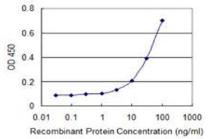 Detection limit for recombinant GST tagged DECR2 is 1 ng/ml as a capture antibody. (DECR2 antibody  (AA 49-109))