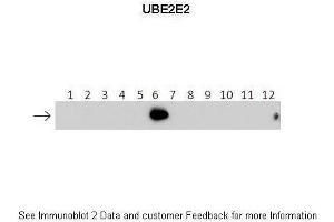 Lanes:   1: 40ng HIS-UBE2D1 protein 2: 40ng HIS-UBE2D2 protein 3: 40ng HIS-UBE2D3 protein 4: 40ng HIS-UBE2D4 protein 5: 40ng HIS-UBE2E1 protein 6: 40ng HIS-UBE2E2 protein 7: 40ng HIS-UBE2E3 protein 8: 40ng HIS-UBE2K protein 9: 40ng HIS-UBE2L3 protein 10: 40ng HIS-UBE2N protein 11: 40ng HIS-UBE2V1 protein 12: 40ng HIS-UBE2V2 protein. (UBE2E2 antibody  (N-Term))