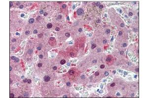 Immunohistochemistry (IHC) image for anti-Glutathione S-Transferase alpha 1 (GSTA1) (AA 1-222) antibody (ABIN782405) (GSTA1 antibody  (AA 1-222))