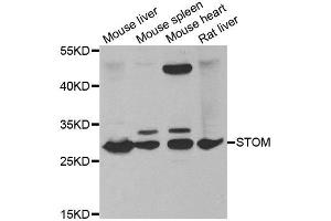Western blot analysis of extracts of various tissues, using STOM antibody. (Stomatin antibody)