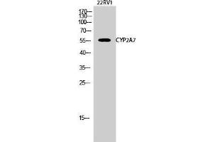 Western Blot (WB) analysis of 22RV1 cells using CYP2A7 Polyclonal Antibody. (CYP2A7 antibody  (C-Term))