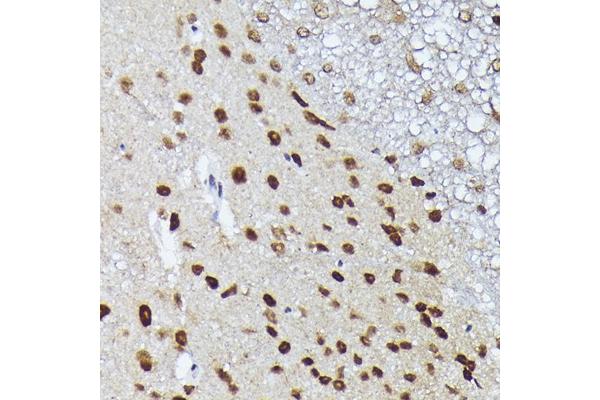 MT2A antibody  (AA 1-61)