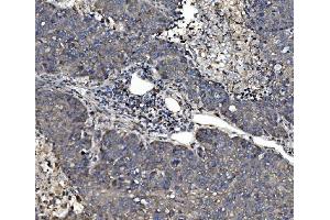 IHC analysis of P4HB using anti-P4HB antibody (ABIN7600075). (P4HB antibody  (AA 146-363))