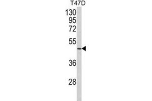 Western Blotting (WB) image for anti-Neutrophil Cytosolic Factor 1C Pseudogene (NCF1C) antibody (ABIN3003869) (NCF1C antibody)