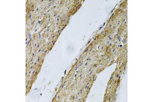 Immunohistochemistry of paraffin-embedded human smooth muscle using VCL Antibody (ABIN5970881) at dilution of 1/100 (40x lens). (Vinculin antibody)