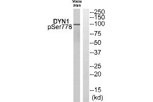 Western blot analysis of extracts from Mouse brain cells, using DYN1 (Phospho-Ser778) antibody. (Dynamin 1 antibody  (pSer778))