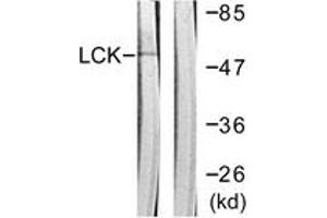 Western blot analysis of extracts from Jurkat cells, using Lck (Ab-192) Antibody.