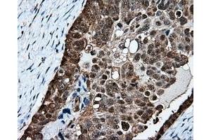 Immunohistochemical staining of paraffin-embedded Kidney tissue using anti-PSMC3 mouse monoclonal antibody. (PSMC3 antibody)