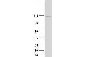 Validation with Western Blot (Stim2 Protein (Myc-DYKDDDDK Tag))