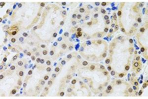 Immunohistochemistry of paraffin-embedded Rat kidney using POP4 Polyclonal Antibody at dilution of 1:100 (40x lens). (RPP29 antibody)