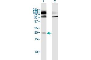 Western Blot analysis of POMP expression in transfected 293T cell line by POMP MaxPab polyclonal antibody.
