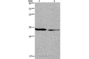 Western blot analysis of 293T and A549 cell, using EMD Polyclonal Antibody at dilution of 1:1600 (Emerin antibody)