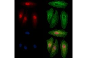 Phospho-PPAR gamma (Ser273) Antibody staining A549 cells(heat shock treatment) by IF/ICC.