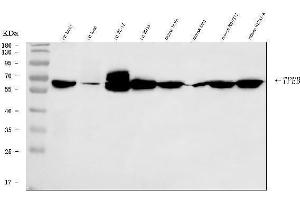Western blot analysis of TFEB using anti-TFEB antibody (ABIN7600648). (TFEB antibody  (AA 214-326))
