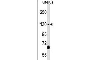KIF27 Antibody (C-term) (ABIN1536712 and ABIN2838099) western blot analysis in Uterus tissue lysates (35 μg/lane). (KIF27 antibody  (C-Term))