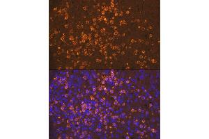 Immunofluorescence analysis of human spleen using Neutrophil Elastase (ELANE) Rabbit mAb (ABIN7266912) at dilution of 1:100 (40x lens). (ELANE antibody)