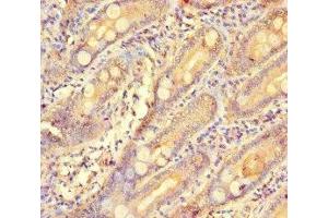 Immunohistochemistry of paraffin-embedded human small intestine tissue using ABIN7154573 at dilution of 1:100 (GCHFR antibody  (AA 11-55))