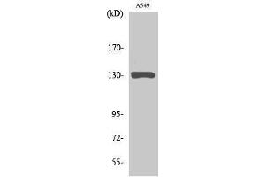 Western Blotting (WB) image for anti-Janus Kinase 1 (JAK1) (Ser639) antibody (ABIN3185253) (JAK1 antibody  (Ser639))