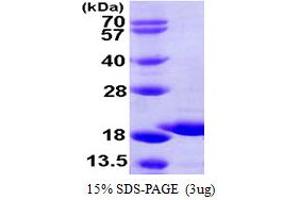 SDS-PAGE (SDS) image for GSK3B interacting protein (GSKIP) (AA 1-139) protein (His tag) (ABIN667415)