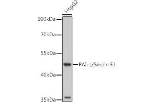 Western blot analysis of extracts of Rat placenta, using PAI-1/Serpin E1 antibody (ABIN6131330, ABIN6147601, ABIN6147603 and ABIN6221802) at 1:1000 dilution. (PAI1 antibody  (AA 24-402))