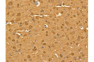 ABIN6264167 and ABIN6269032 at 1/100 staining Rat brain tissue by IHC-P. (UCHL1 antibody  (C-Term))