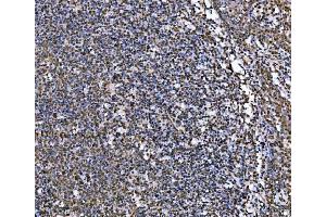 IHC analysis of MRE11 using anti-MRE11 antibody (ABIN7601056). (Mre11 antibody  (AA 278-498))