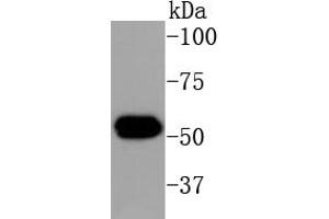 KRT16 anticorps