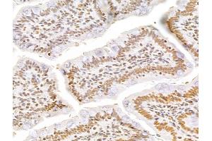ABIN7094256 and ABIN7098303 at 1/100 staining Rat colon tissue by IHC-P. (GINS3 antibody  (Internal Region))