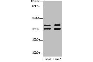 IKbIP antibody  (AA 121-350)