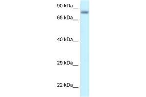 WB Suggested Anti-PPP6R3 Antibody Titration: 1. (PPP6R3 antibody  (C-Term))