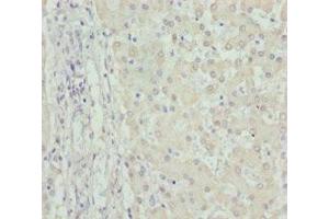 Immunohistochemistry of paraffin-embedded human liver tissue using ABIN7149965 at dilution of 1:100 (FMO5 antibody  (AA 1-285))