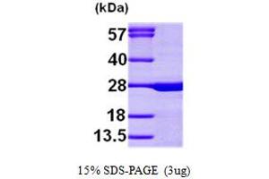 SDS-PAGE (SDS) image for Calcium Binding Protein P22 (CHP) (AA 1-195) protein (His tag) (ABIN667023)