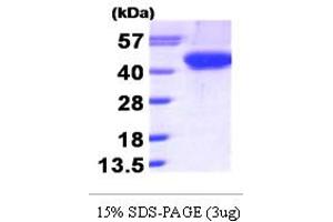 SDS-PAGE (SDS) image for Aurora Kinase B (AURKB) (AA 1-344) protein (His tag) (ABIN668044)