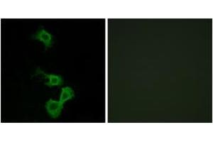 Immunofluorescence analysis of MCF7 cells, using Dab1 (Ab-232) Antibody. (DAB1 antibody  (AA 199-248))