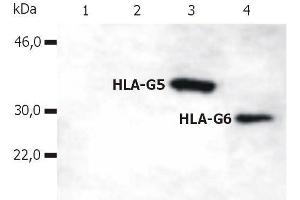 Western Blotting analysis of whole cell lysate of HLA-G stable transfectants (various splice variants) using anti-human HLA-G (5A6G7). (HLAG antibody  (C-Term) (Biotin))