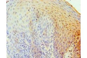 Immunohistochemistry of paraffin-embedded human tonsil tissue using ABIN7173838 at dilution of 1:100 (TNFRSF1D (AA 257-386) antibody)