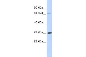 WB Suggested Anti-FCER1A Antibody Titration:  0. (Fc epsilon RI/FCER1A antibody  (Middle Region))
