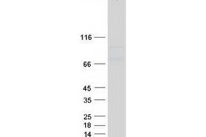 Validation with Western Blot (HMMR Protein (Transcript Variant 2) (Myc-DYKDDDDK Tag))