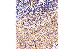 Immunohistochemical analysis of paraffin-embedded M. (CSK antibody  (N-Term))