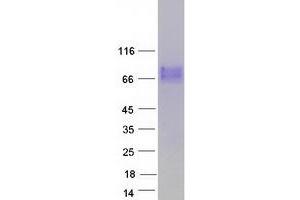 Validation with Western Blot