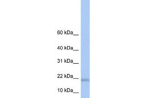 WB Suggested Anti-LOC284009 Antibody Titration: 0. (LOC284009 antibody  (N-Term))