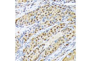 Immunohistochemistry of paraffin-embedded rat ovary using FKBP51/FKBP5 Rabbit mAb (ABIN7267213) at dilution of 1:100 (40x lens). (FKBP5 antibody)