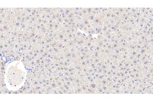 Detection of ADH1 in Mouse Liver Tissue using Polyclonal Antibody to Alcohol Dehydrogenase 1 (ADH1) (ADH1 antibody  (AA 25-228))