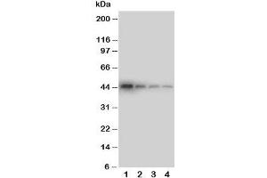 Western blot testing of DDR1 antibody and Lane 1:  recombinant human protein 10ng;  2: 5ng;  3: 2.