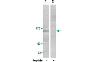 Western blot analysis of extracts from HeLa cells, using COL4A1 polyclonal antibody . (COL4A1 antibody  (AA 31-70))