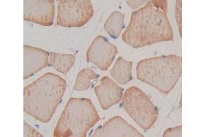 Figure. (TNNT1 antibody  (AA 1-228))