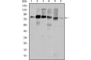 Western blot analysis using CTTN mouse mAb against Hela (1), A431 (2), MCF-7 (3), SR-BR-3 (4), HepG2 (5) and NIH/3T3 (6) cell lysate. (Cortactin antibody)