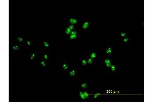 Immunofluorescence of purified MaxPab antibody to DDX47 on HeLa cell. (DDX47 antibody  (AA 1-455))