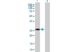 Western Blot analysis of AAAS expression in transfected 293T cell line by AAAS MaxPab polyclonal antibody. (Adracalin antibody  (AA 1-546))