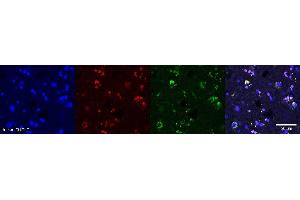 Immunohistochemistry (IHC) image for anti-Oligodendrocytic Myelin Paranodal and Inner Loop Protein (OPALIN) antibody (ABIN7456142) (OPALIN antibody)